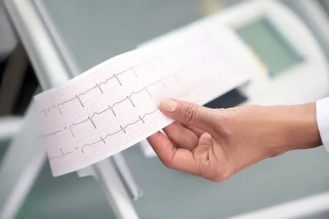 Hand hält einen EKG-Ausdruck mit Herzkurven